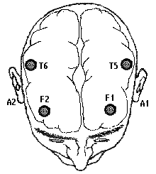 Testa3