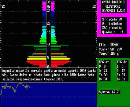 eeg1