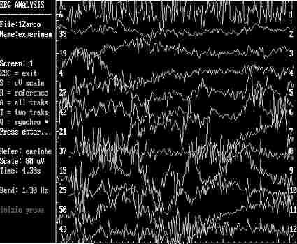 eeg10