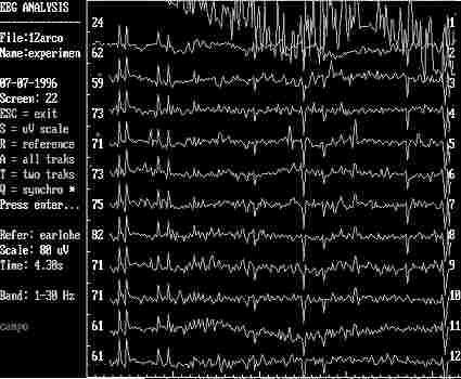 eeg11