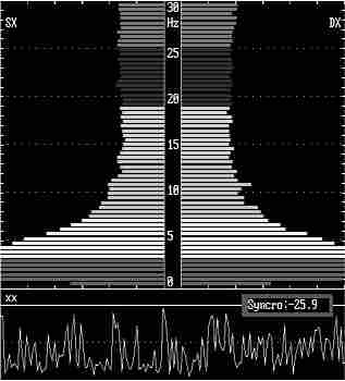 eeg4