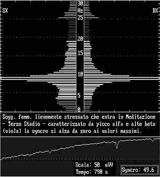 eeg6