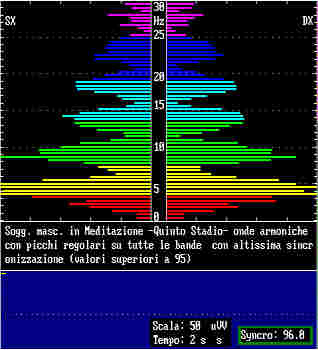 eeg7