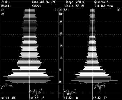 eeg8