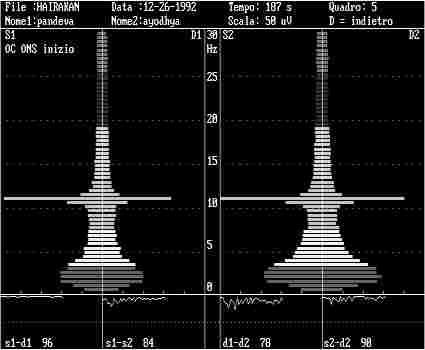 eeg9